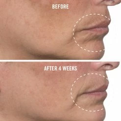 Promo 🛒 First Aid Beauty Ultra Repair Firming Collagen Cream 🥰 -skin care store unnamed file 562