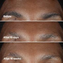 Best Pirce 👏 Clinique Smart Clinical Repair Wrinkle Correcting Serum 🛒 -skin care store unnamed file 578