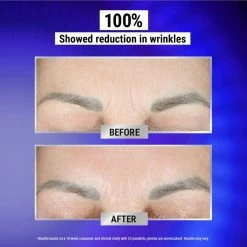 New ⭐ Kiehl's Retinol Fast Release Wrinkle Reducing Night Serum 🔔 -skin care store unnamed file 636